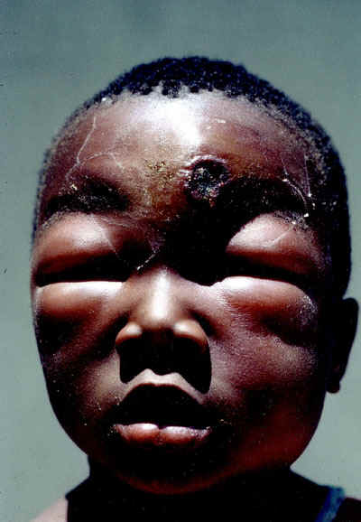 Childwanthrax80.jpg (69406 bytes)